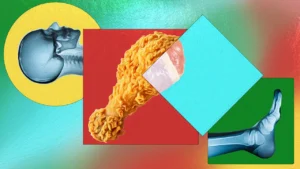 AI Creates Fake X-Rays That Fool Expert Doctors